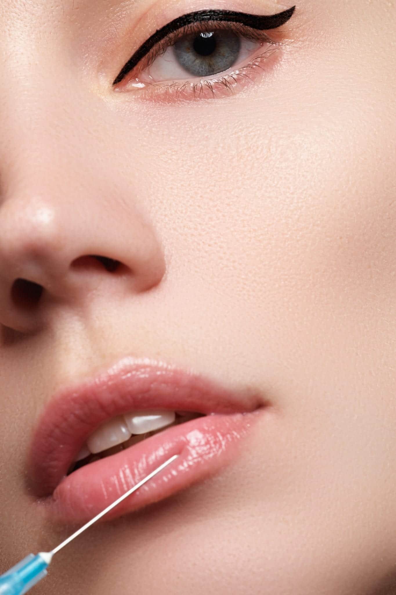 Juvederm Palm Desert CA