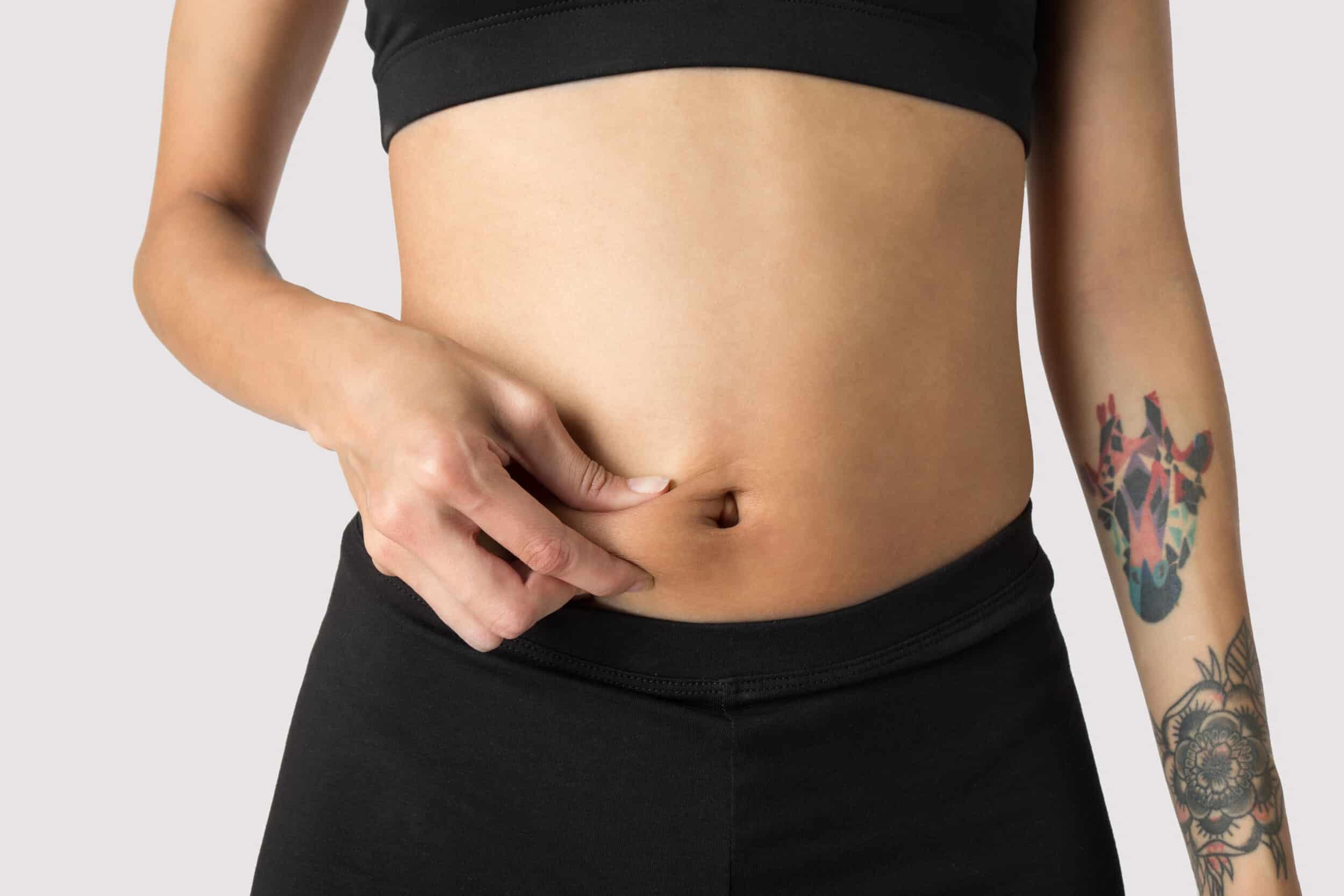 Abdominoplasty Palm Springs CA