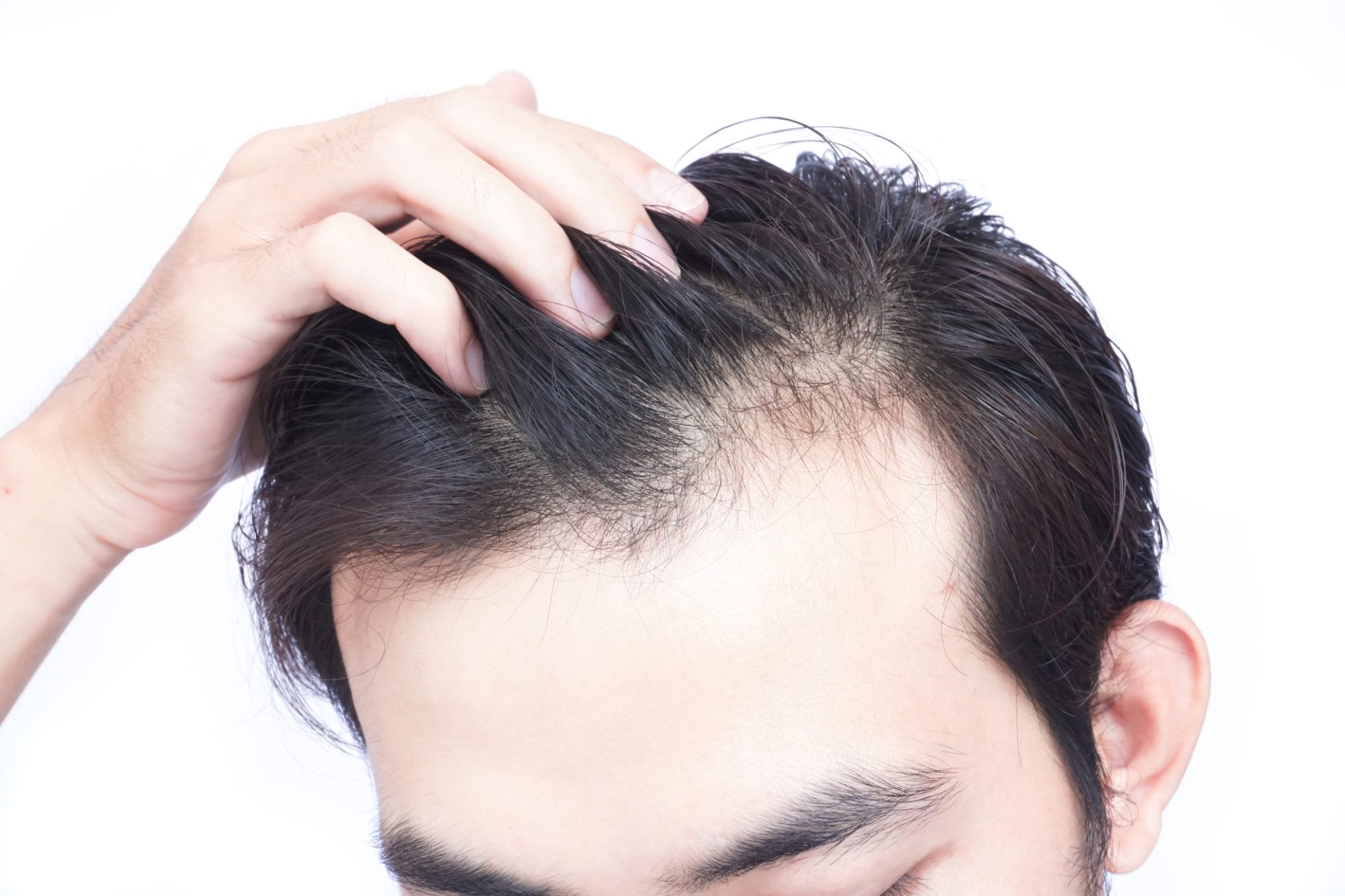 Viviscal Professional Hair Loss Treatment Palm Springs CA